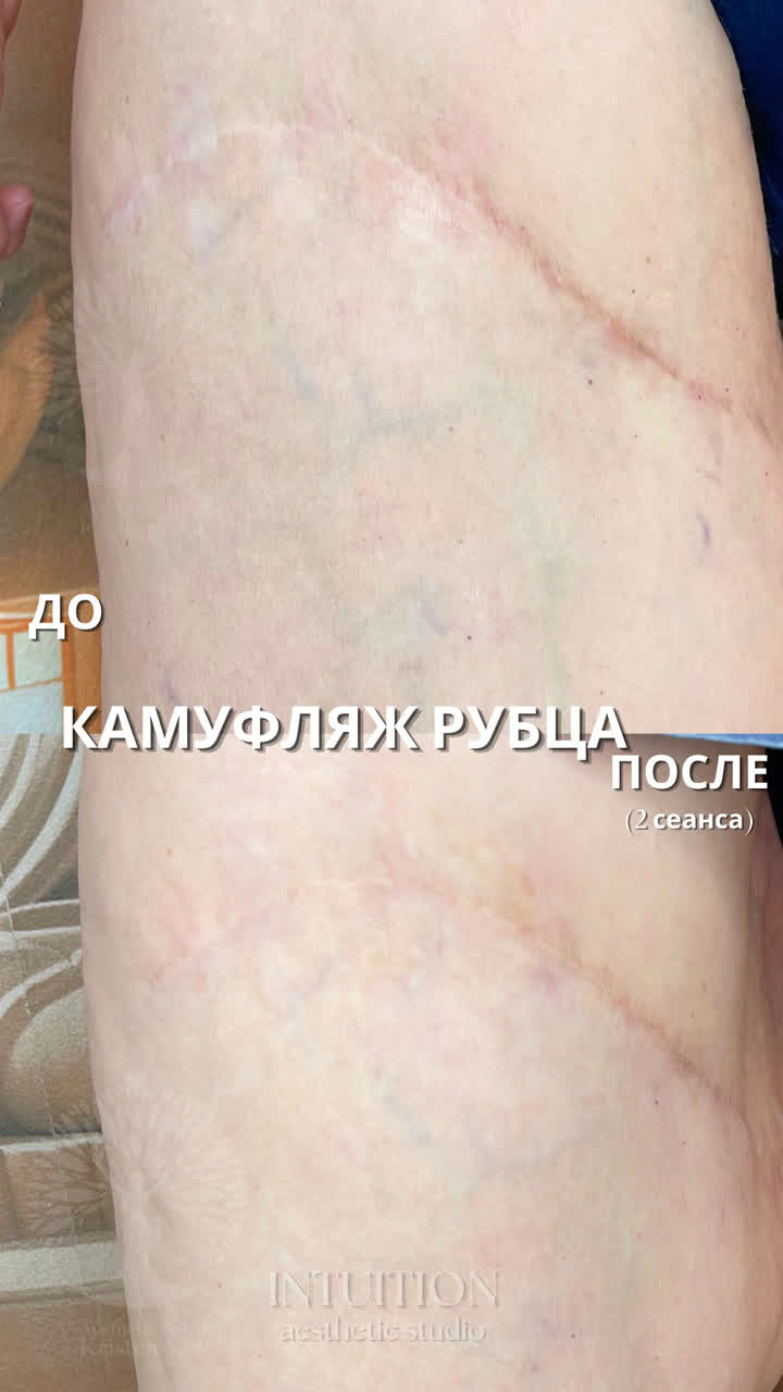 camouflage-of-scars-and-marks-intuition-studio-minsk-01.jpg