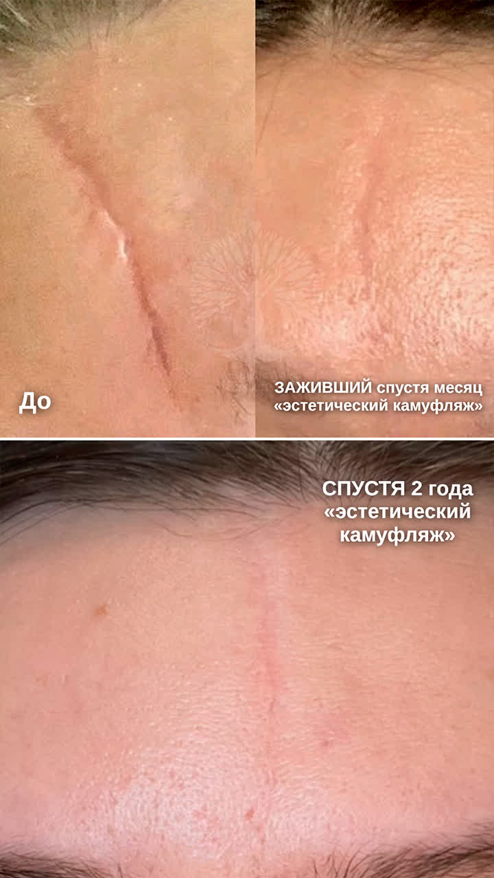 camouflage-of-scars-and-marks-intuition-studio-minsk-01.jpg