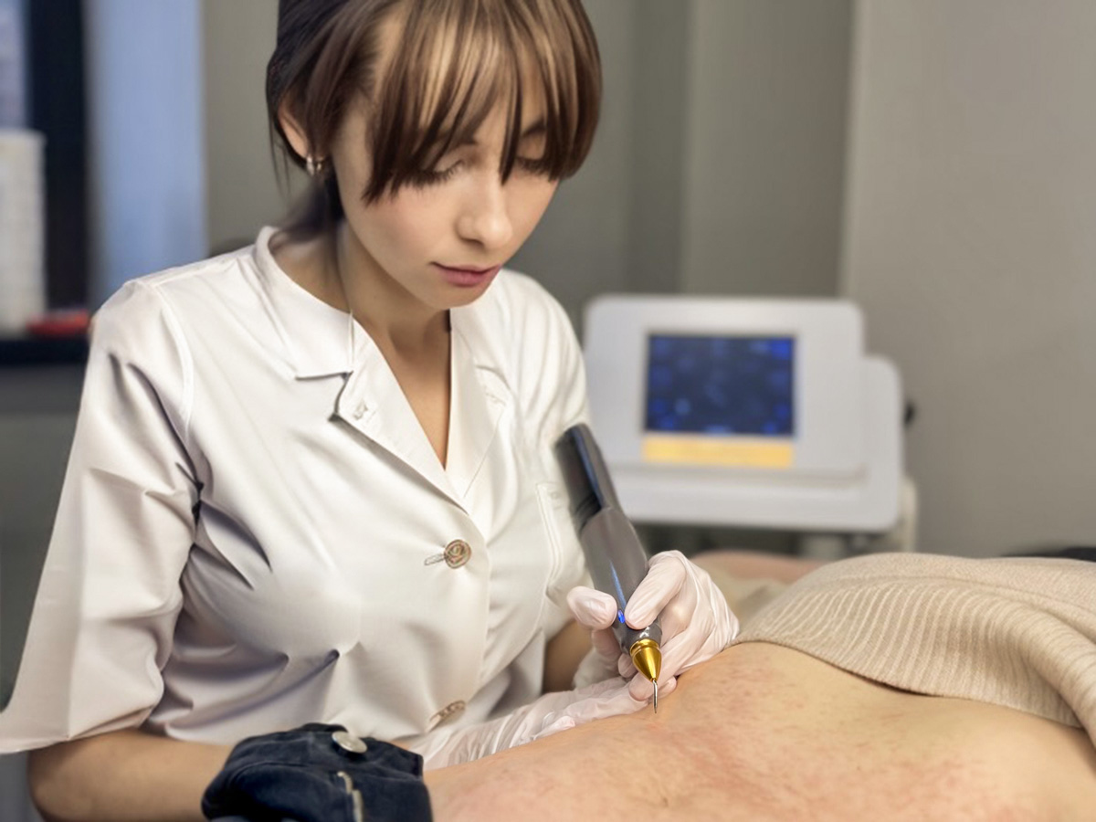 холодная плазма, холодная плазма цена, холодная плазам головы, холодная п отзывы, холодная плазма волос женщины, холодная плазма стоимость, холодная плазма кожи головы, холодная плазма, холодная плазма в Беларуси, холодная плазма Минск, холодная плазма отзывы