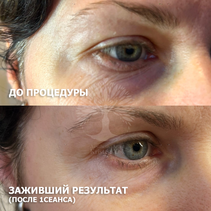 холодная плазма, холодная плазма цена, холодная плазам головы, холодная п отзывы, холодная плазма волос женщины, холодная плазма стоимость, холодная плазма кожи головы, холодная плазма, холодная плазма в Беларуси, холодная плазма Минск, холодная плазма отзывы