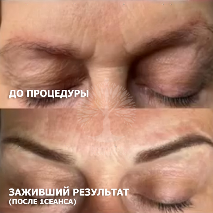 холодная плазма, холодная плазма цена, холодная плазам головы, холодная п отзывы, холодная плазма волос женщины, холодная плазма стоимость, холодная плазма кожи головы, холодная плазма, холодная плазма в Беларуси, холодная плазма Минск, холодная плазма отзывы