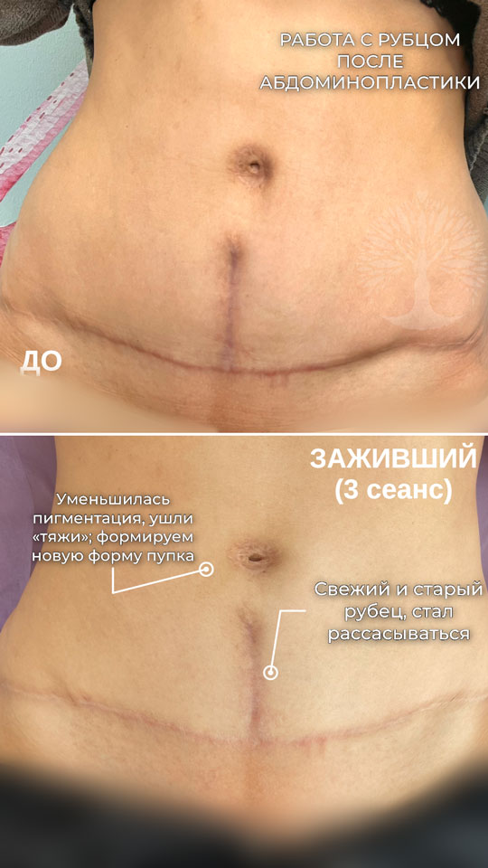 холодная плазма, холодная плазма цена, холодная плазам головы, холодная п отзывы, холодная плазма волос женщины, холодная плазма стоимость, холодная плазма кожи головы, холодная плазма, холодная плазма в Беларуси, холодная плазма Минск, холодная плазма отзывы