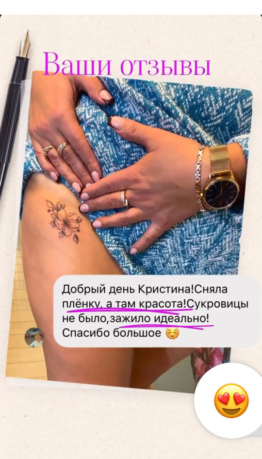 comments 24
