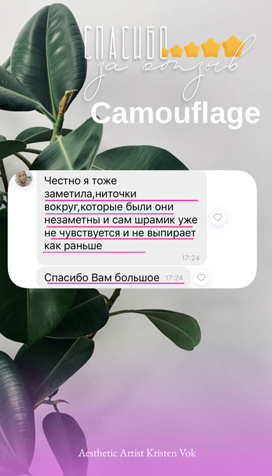 comments 25