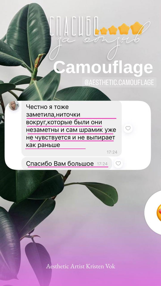 эстетический камуфляж шрамов отзывы