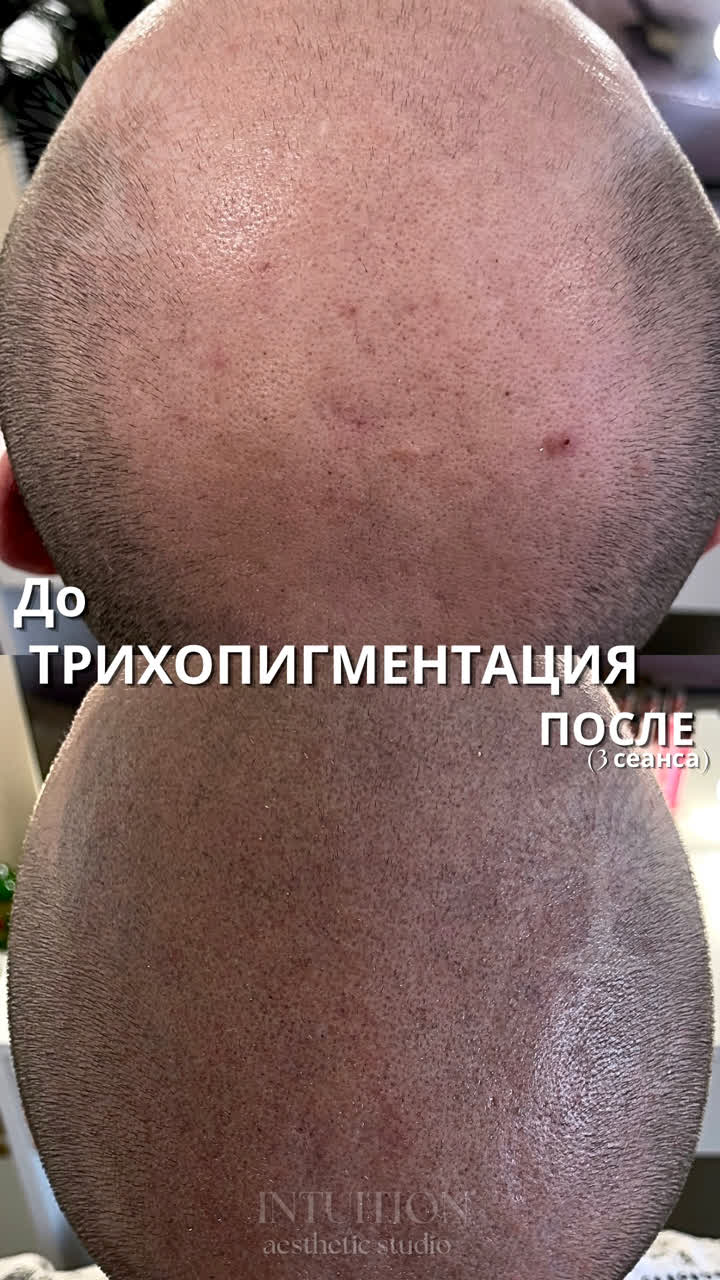 trichopigmentation-intuition-studio-minsk
